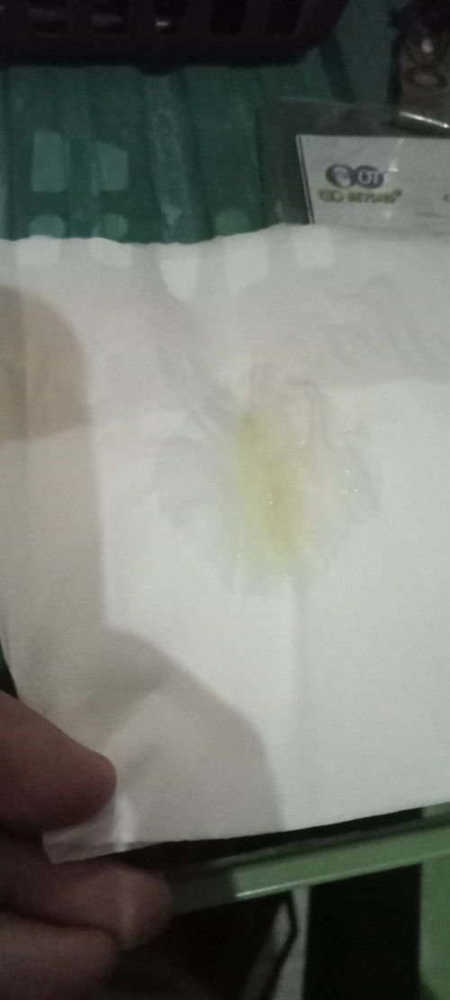 Usia kehamilan 38 Minggu 6 hari