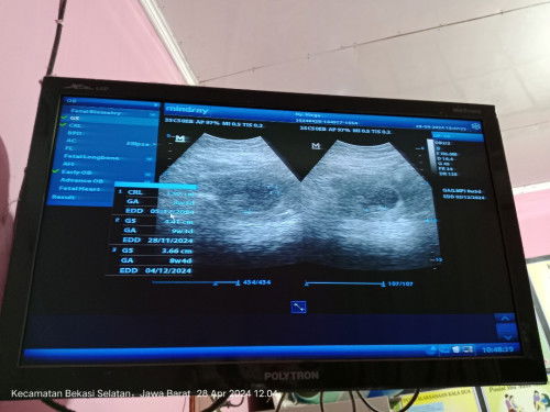 Hamil usia kandungan 9 week