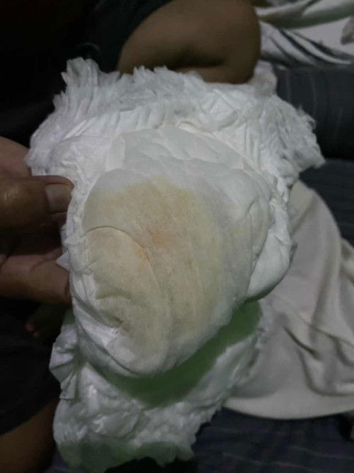 seperti ada noda merah apakah aman?