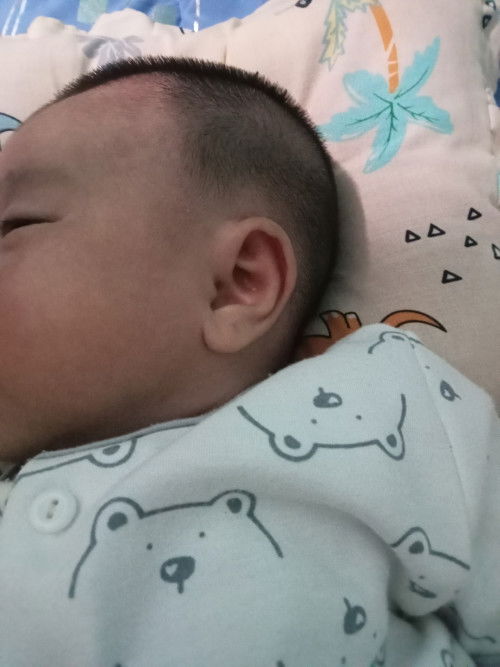 Kepala bayi usia 1bln