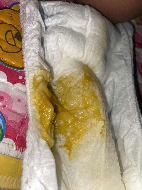 FOTO PUP‼️ pup bayi 4 bulan berlendir apakah normal?