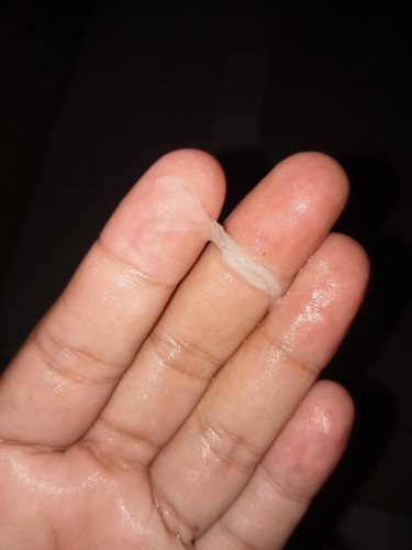 แบบนี้ใช่มูกหรือเปล่า