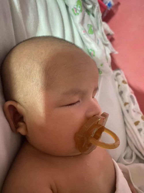 สงสัยเรื่องจุกดูดค่ะ