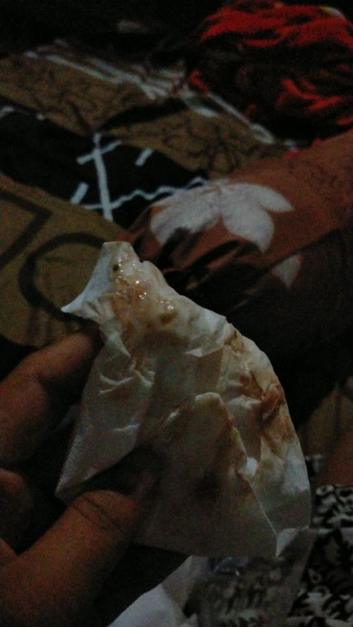 Keluar lendir campur darah udah 3 harian ini bund itu kenapa yah apa mau melahirkan kah?