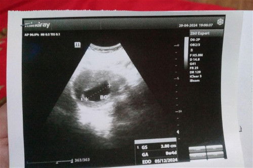 Bantu dijawab ya bundaa