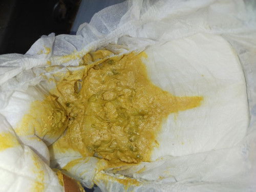 tahi baby warna mustard tp ada tompokan hitam