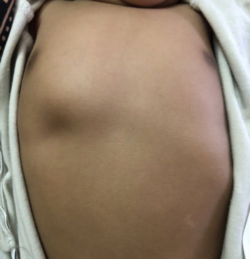 Dada kanan baby 3 bulan lekok kedalam .