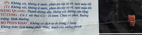 Có ai có thai 7w chưa có phôi hong ạ