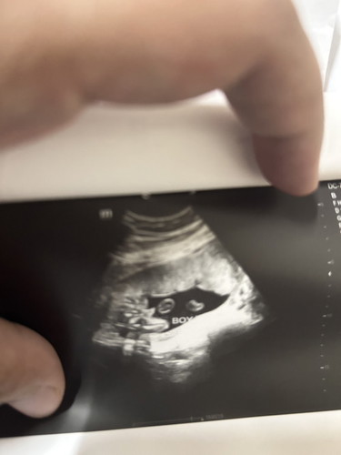 20 weeks 1 day