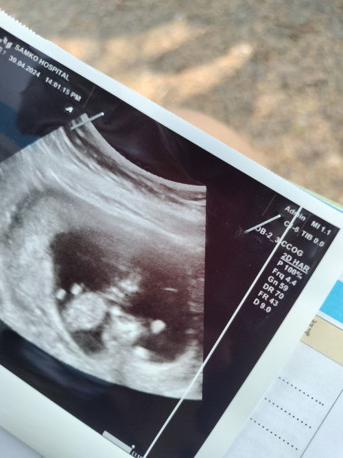 ท้องแฝด❤️❤️