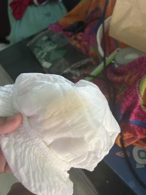 ลูกฉีน้อยมากเป็นอะไรมั้ย