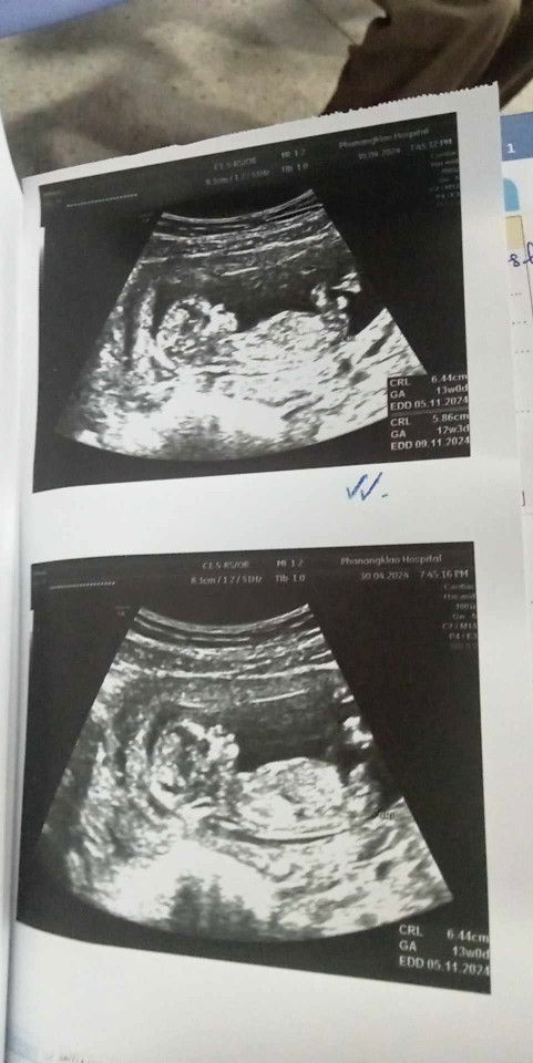 แม่ๆคิดว่าน้องตัวโตมั้ยค่ะ