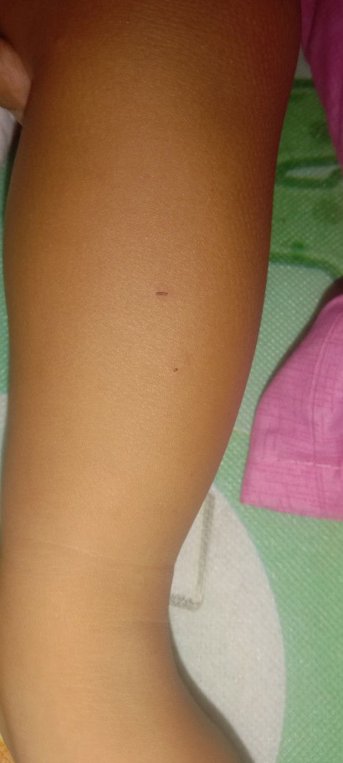 Nakagat ng pusa ang lo ko