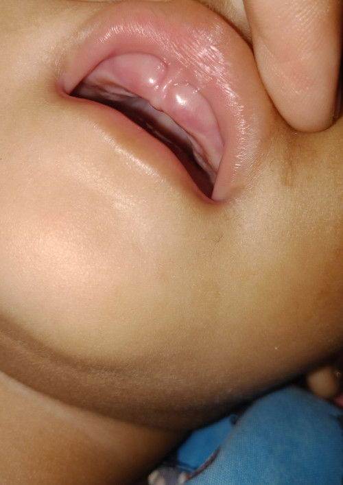 Hii Mom Ini Anak Aku Usia 9 Bulan 18 Hari Kemaren Dia Demam selama 2 hari,