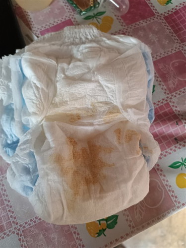 Ano po kaya ito mga mie? Konti nalang po kung umihi anak ko at nkita ko rin to na may yellow stain😢