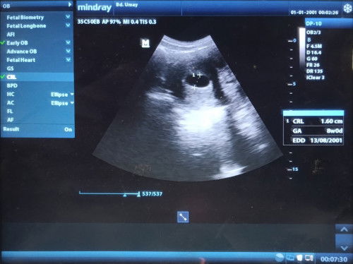 Kantung masih kosong