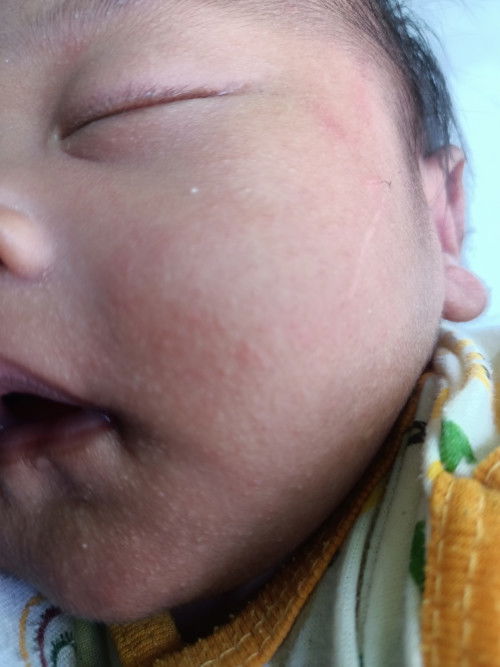 bayi nb 1 bulan pipi merah2