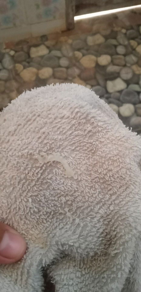 ท้อง37+2w...