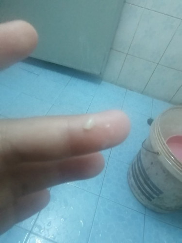 มันคืออะไร