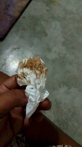 โดนกระตุ้น