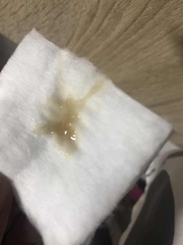 37+3 ท้องเเรกค่ะ