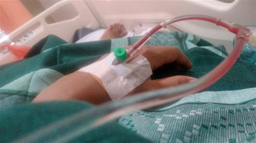 oprasi sc pdahal hpl nya 21mei