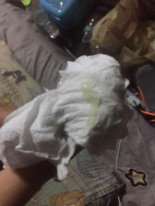 ท้อง36+2เช็ดแล้วมีมูกออกแบบนี้ปกติไหมคะแม่ๆ