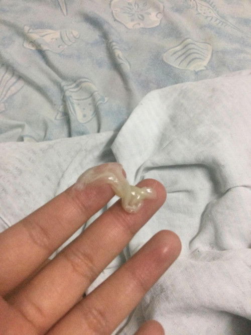 มูกขาวแบบนี้ คือสัญญาณใกล้คลอดไหมคะ