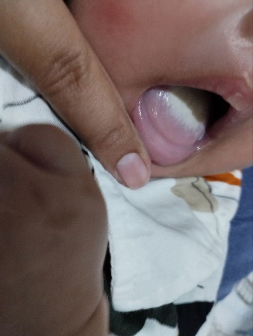 Lidah bayi putih