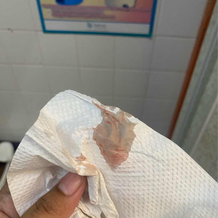 Haid atau implantasi
