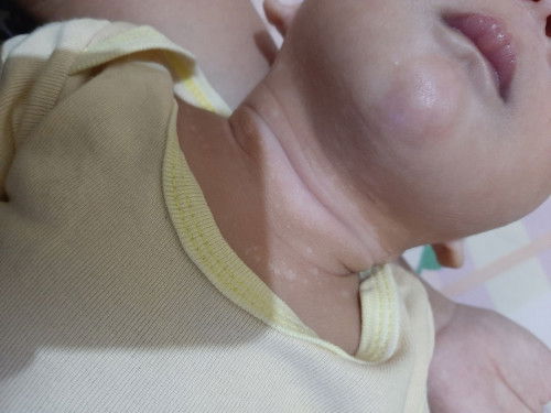 kira kira bisa hilang ga ya bund