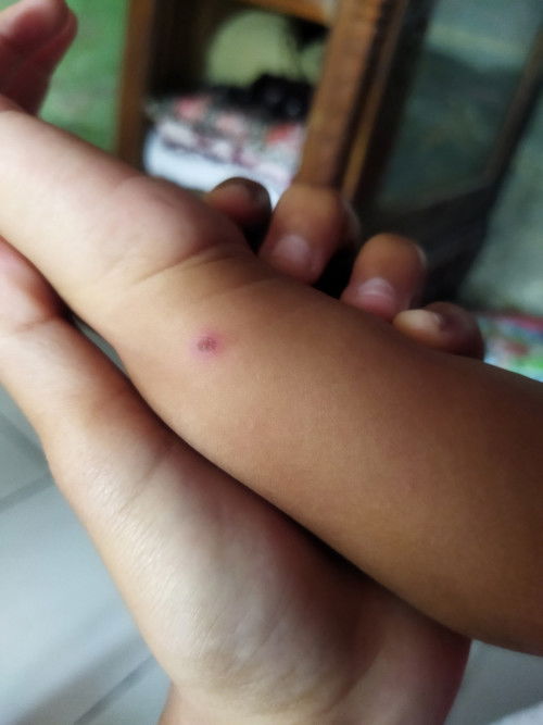 Mau tanya ini kenapa ya? Muncul pas lgi di kmpung,klo udh ilang membekas item