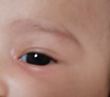 มดกัดลูก