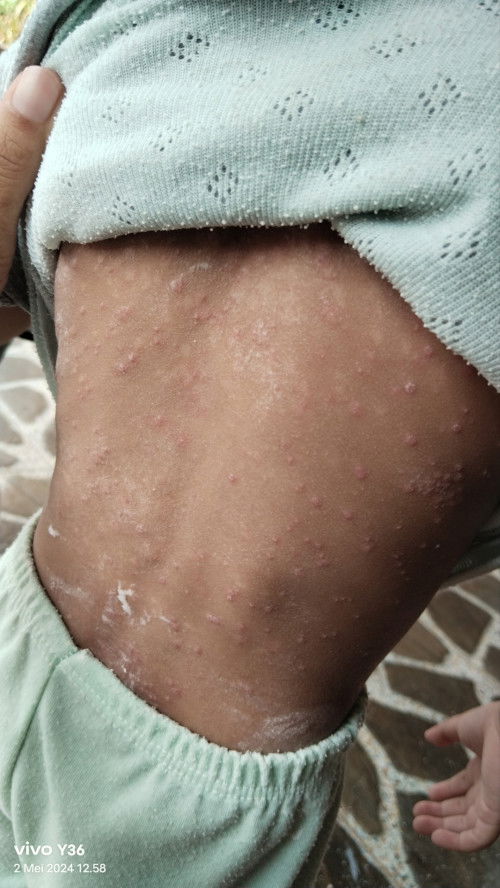 ada yang tau harus pake apa atau gimana