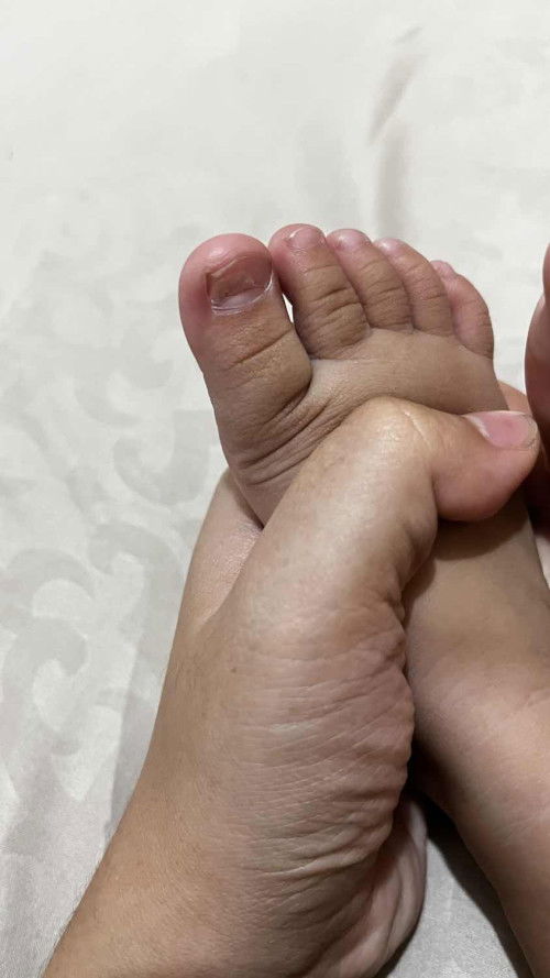 Kuku bengkok dan seperti patah di dalam