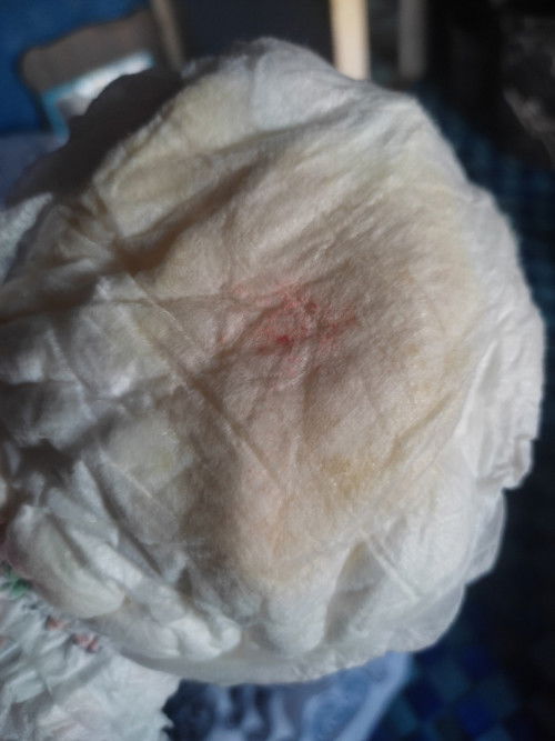 Air kencing ada merah-merah