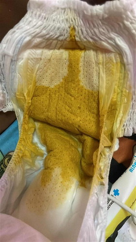 สอบถามแม่ๆค่ะ