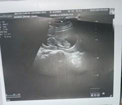 What do you think mga mommy girl o boy ?
Hehehehe excited ako malaman gender ni baby 🥰