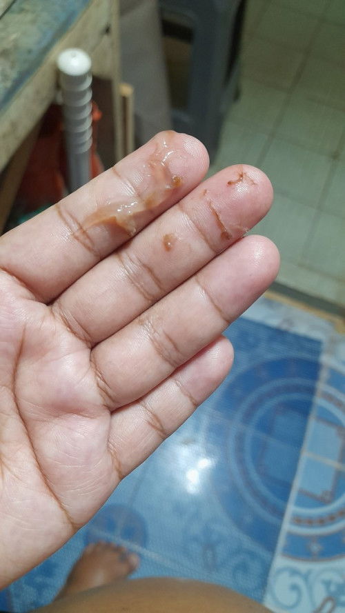 ฝากแม่ๆแชร์ประสบการณ์ รอคลอดหน่อยค่ะ