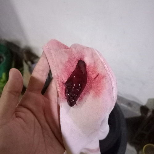 38week keluar gumpalan darah