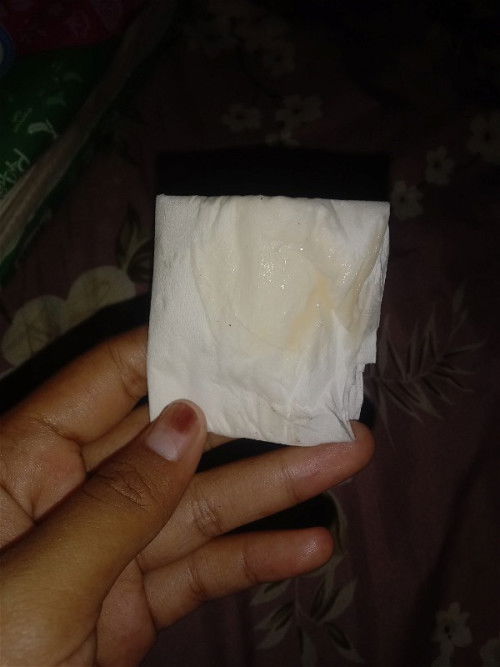 Keputihan atau bukan