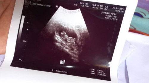 Belum ngrasain gerakan bayi