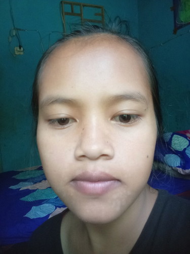 Mau tanya apa disini ada yang mukanya banyak panu/kurap diwajahnya...?😭solusinya Bun...ngk PD 😭