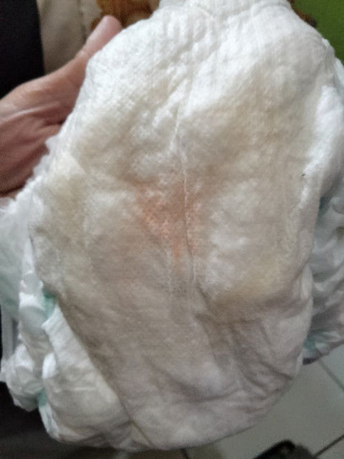 Pipis bayi berwarna orange