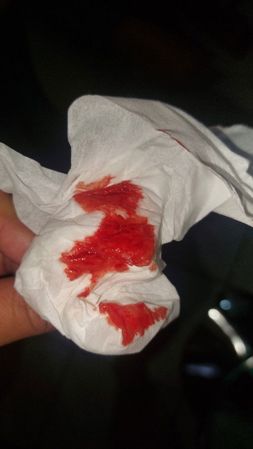 Keluar darah diusia kandungan 39w1day