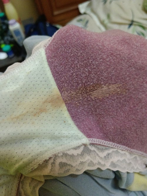 Keluar cairan coklat