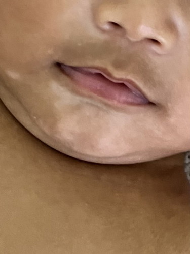 sopak baby