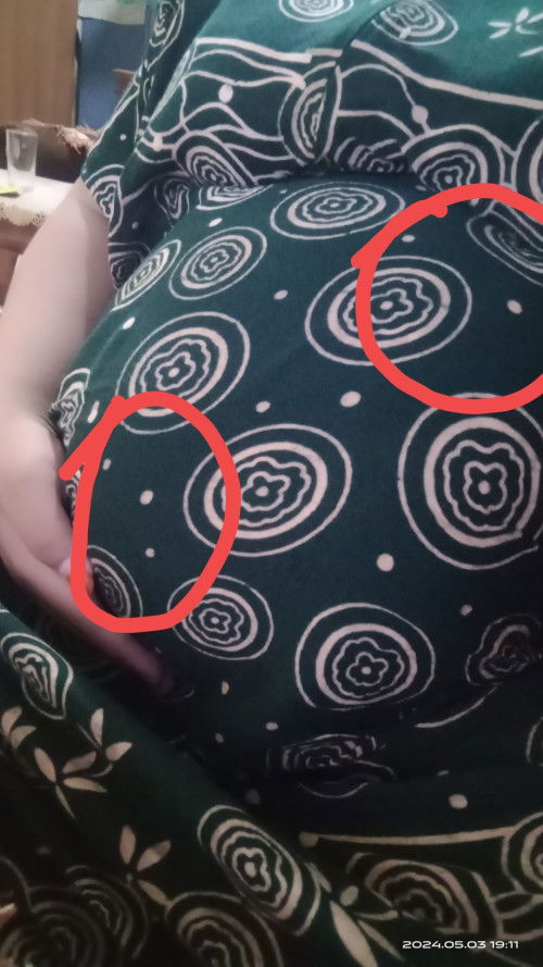 36minggu.kenapa ya letak perut yang mengeras tidak lurus.