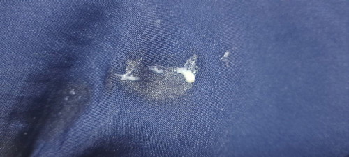 ตกขาวแบบนี้คืออะไรคะ