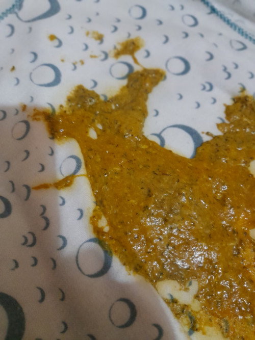 Bun, kok pup anak saya ada item2 kyk cacing